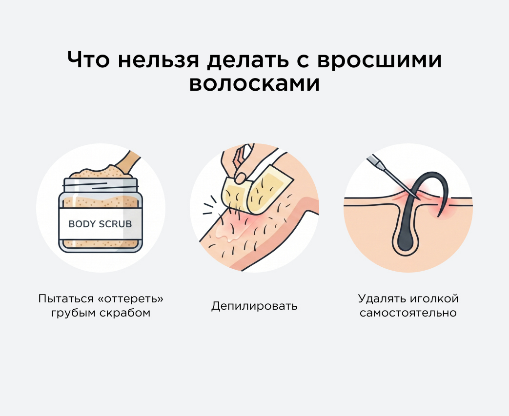 Что нельзя делать с вросшими волосками  